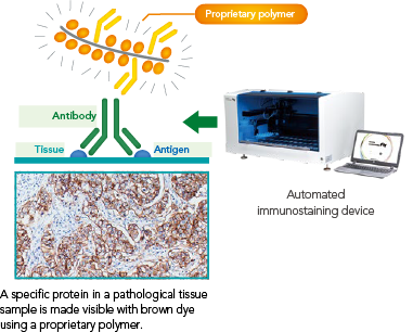 [Principle of Companion Diagnostics] Application of Proprietary Technology to Immunohistochemical Staining